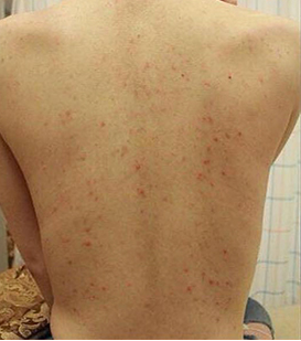 mun lung