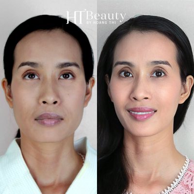 HIEU QUA DICH VU NANG CO