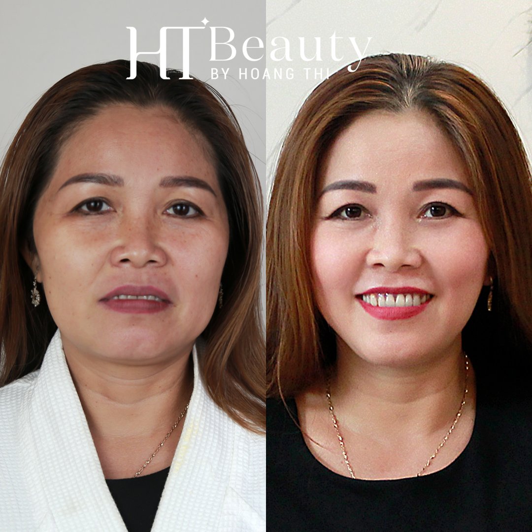 TRUOC SAU NANG CO MAT