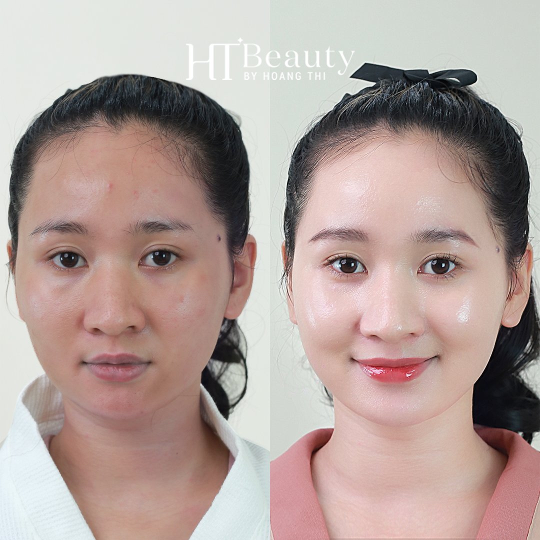 TRUOC SAU TRANG DA MAT