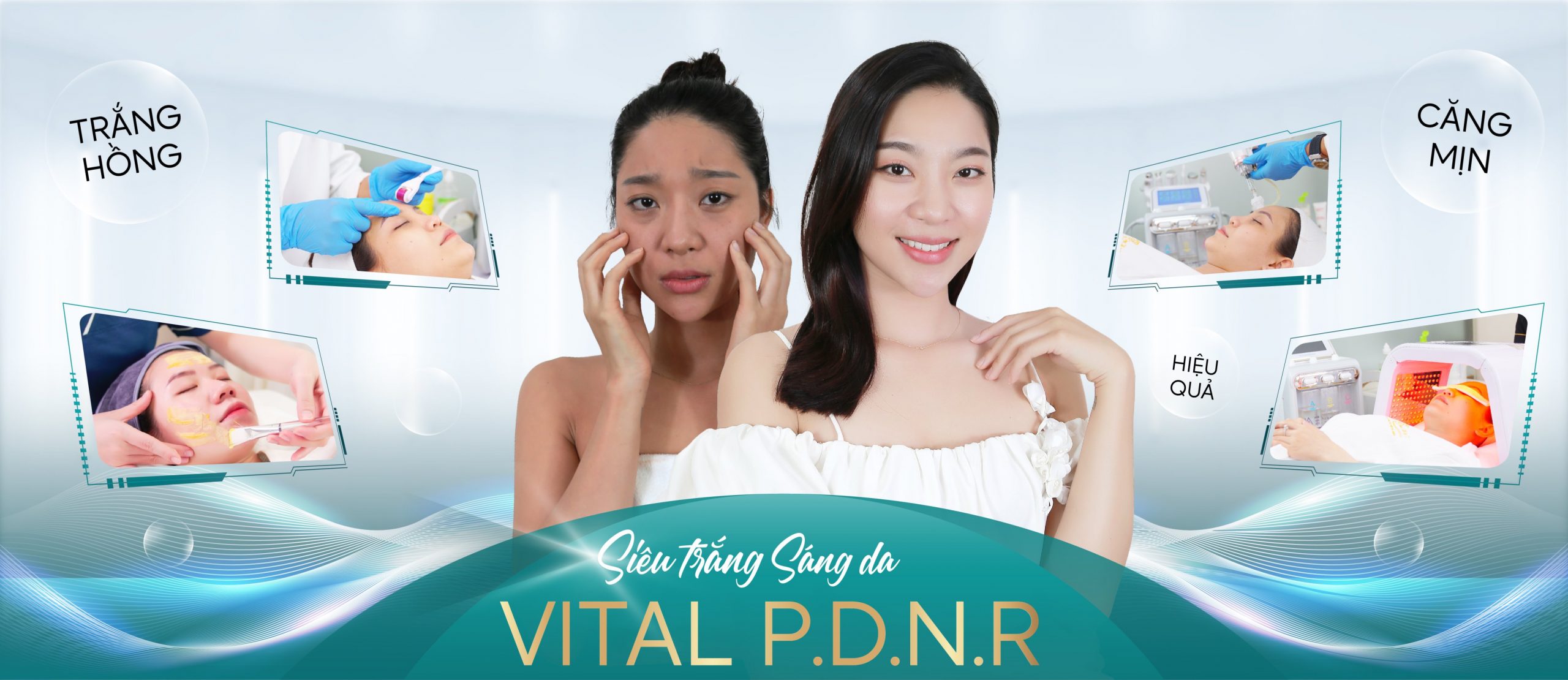 VITAL P.D.N.R1 scaled