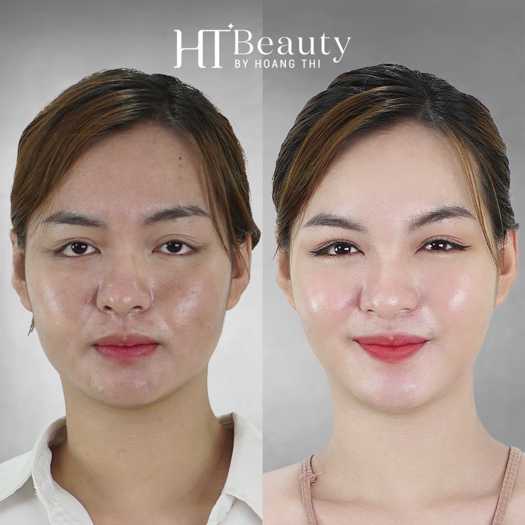 hieu qua lam trang da mat