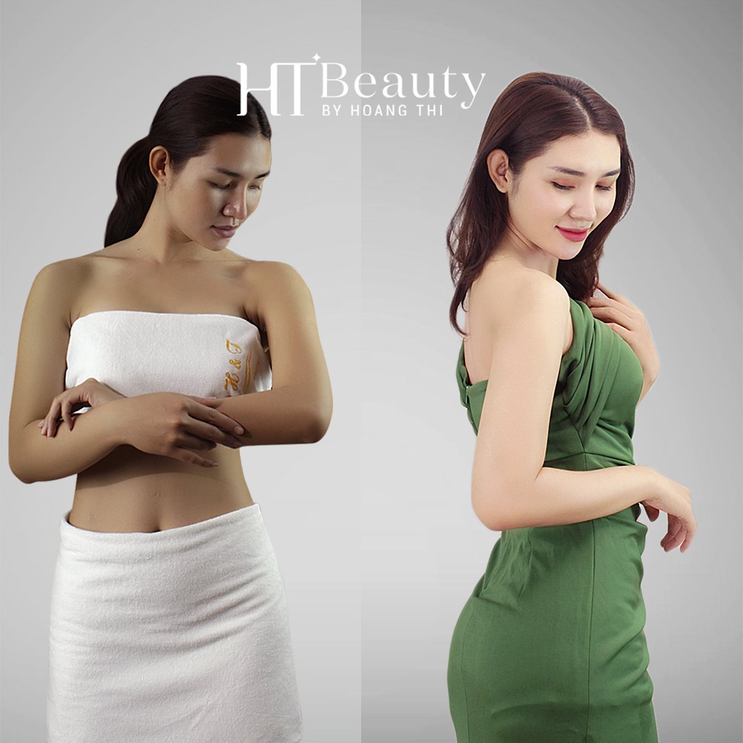 hieu qua tam trang