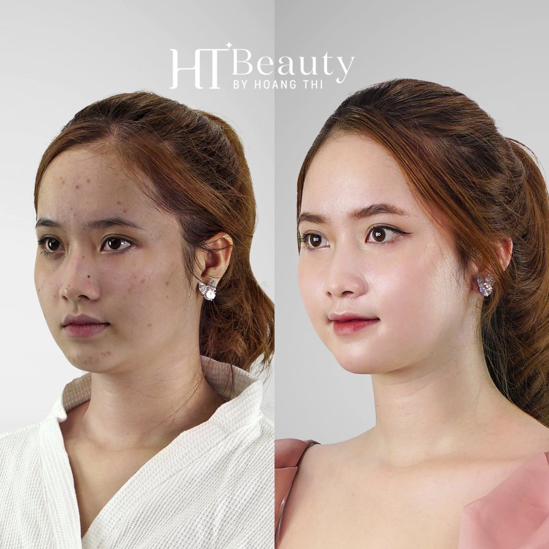 hinh truoc sau trang da mat