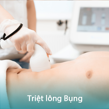 Triệt lông bụng