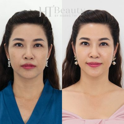 premium gloval c trang