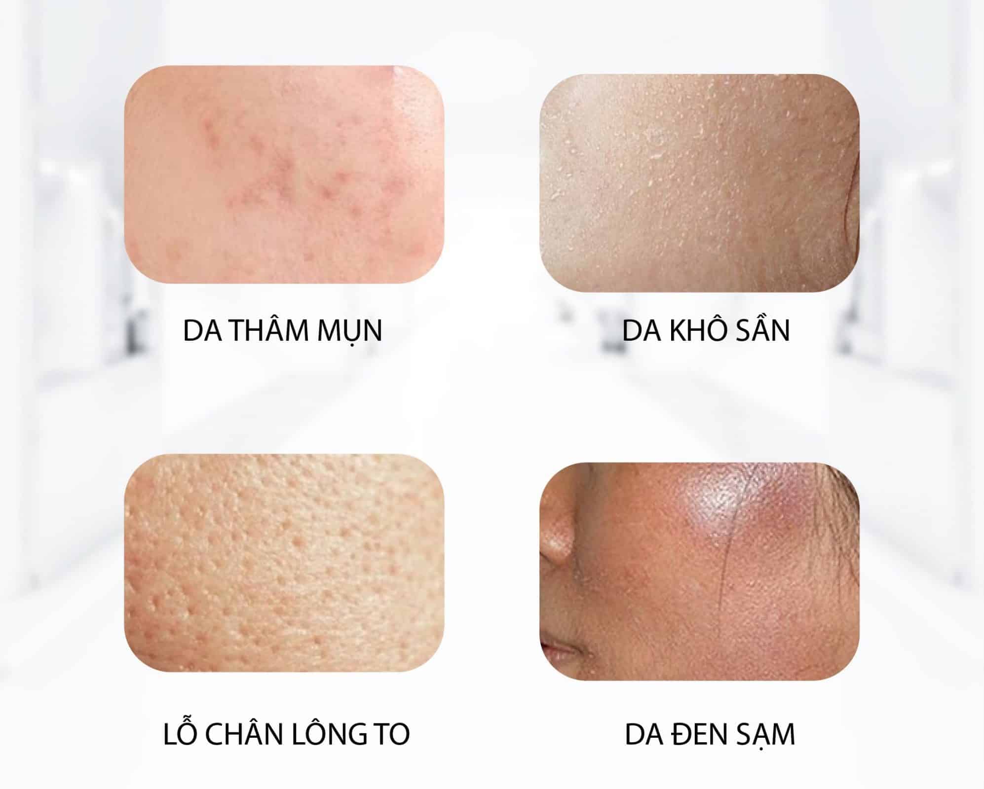 Tái sinh da Premium Gloval