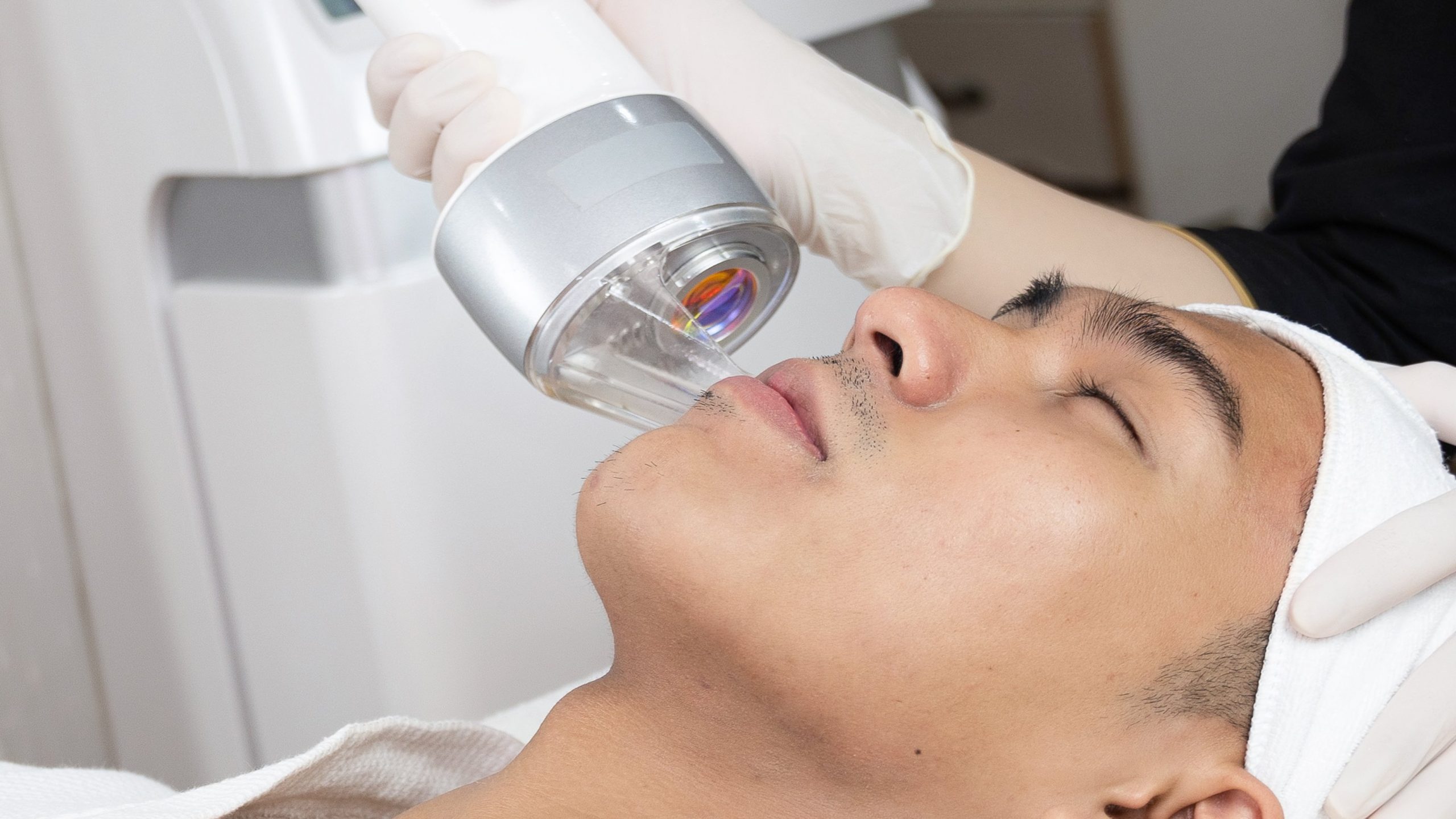 Trị sẹo ultra microcar bắn máy