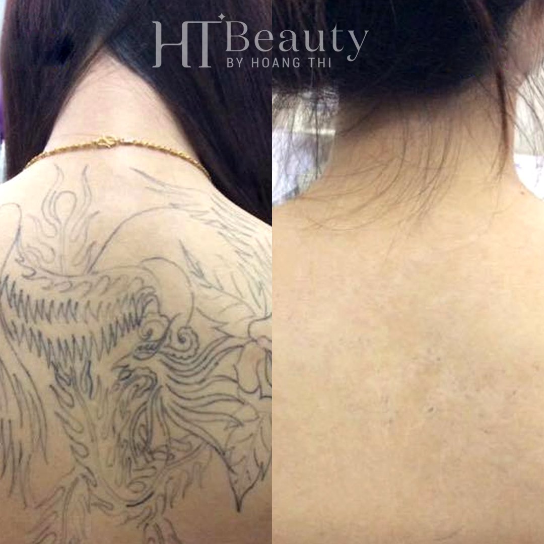 hiệu quả xoá