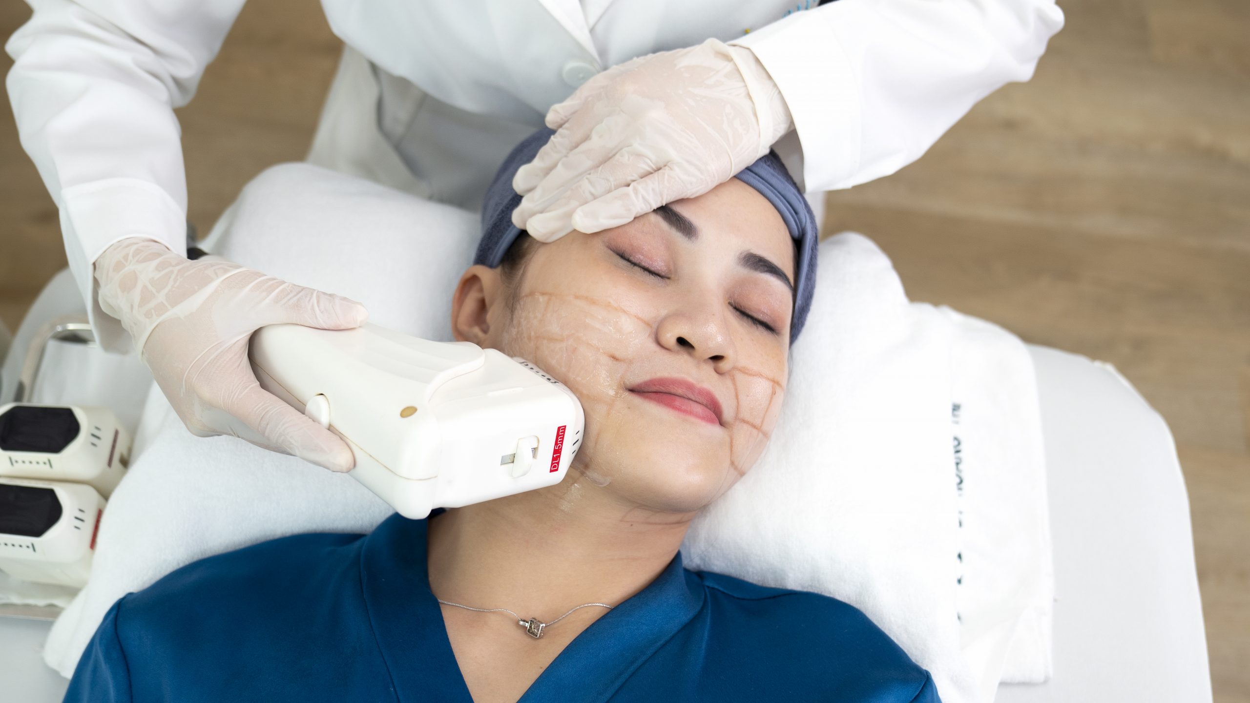 xoá tan nọng cằm scaled