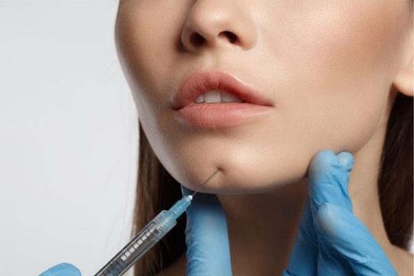 Ưu điểm của tiêm filler cằm