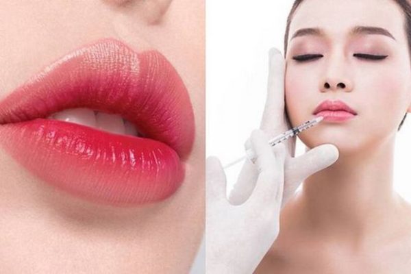 tiêm môi trái tim là gì? 5+ giải đáp thắc mắc