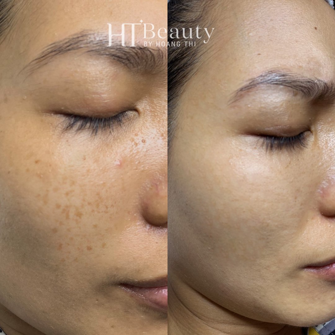 z4131924081776 9b6774365477da910a804b787e0dcb66