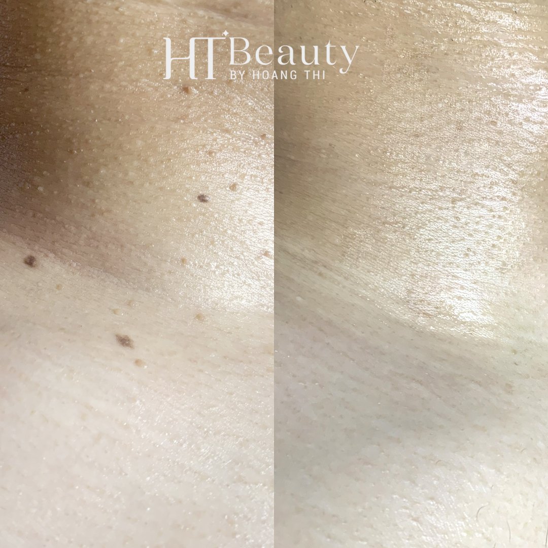 z4136534174821 32506b45a68e94d52135aef38b7e8d4b 1