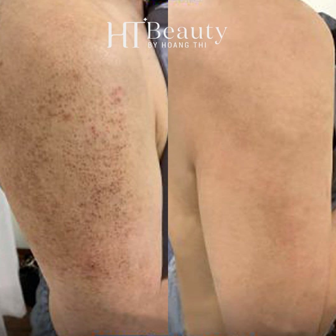 z4136598562535 e97c4cd93e04b81e3ed3803cb28c5ec8