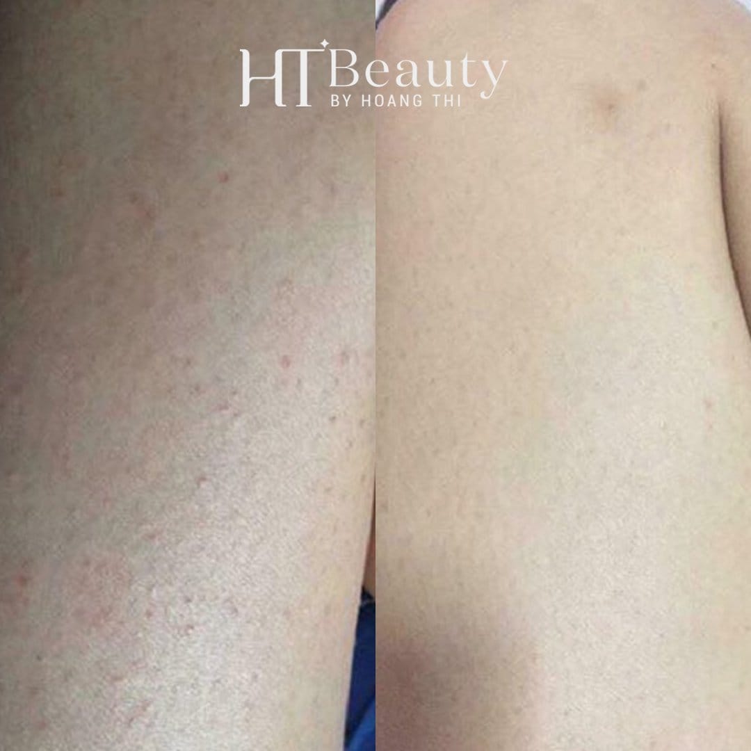 z4136598569516 07f371a116833615e088face95b061fb