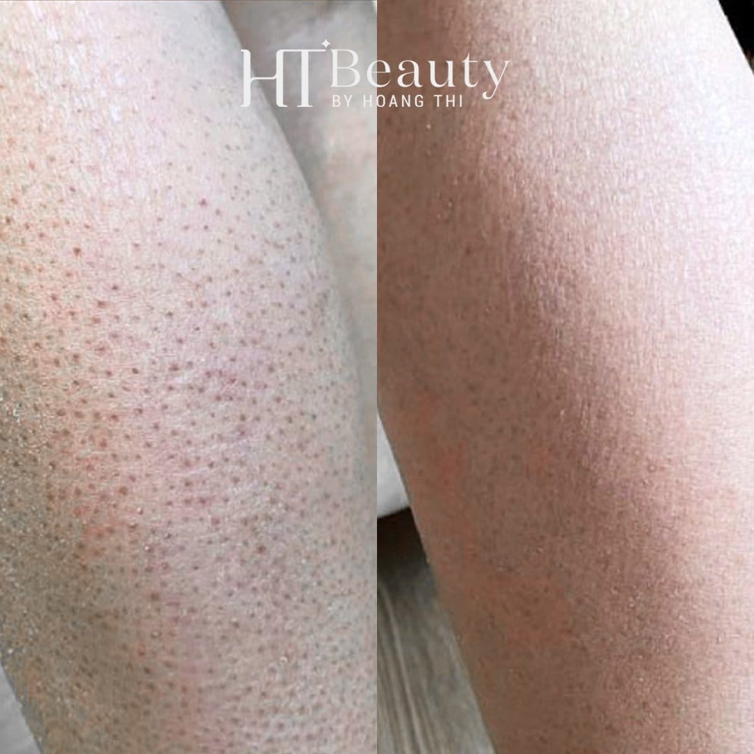 z4136598586720 49261c68f17334f2347232cd1c753922