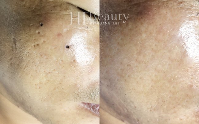 z4136937596752 15ef1b4dc2284c02dc6595b30665cec3