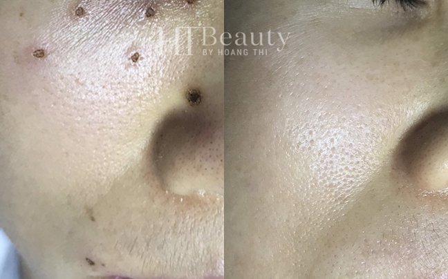 z4136937597155 a954f2eb60f712d6c80fcd40fce51464