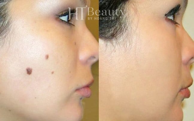 z4144617554621 7205233ca9c3c8fe283d00340d37ae49