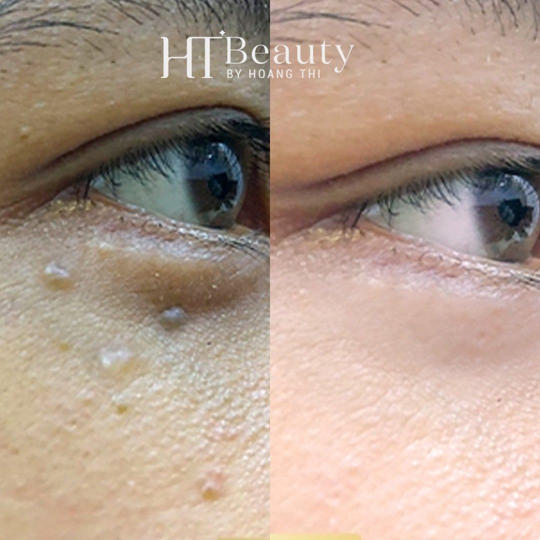 z4144653782530 dc4e55c88f4a3499bd5009da38f2f119