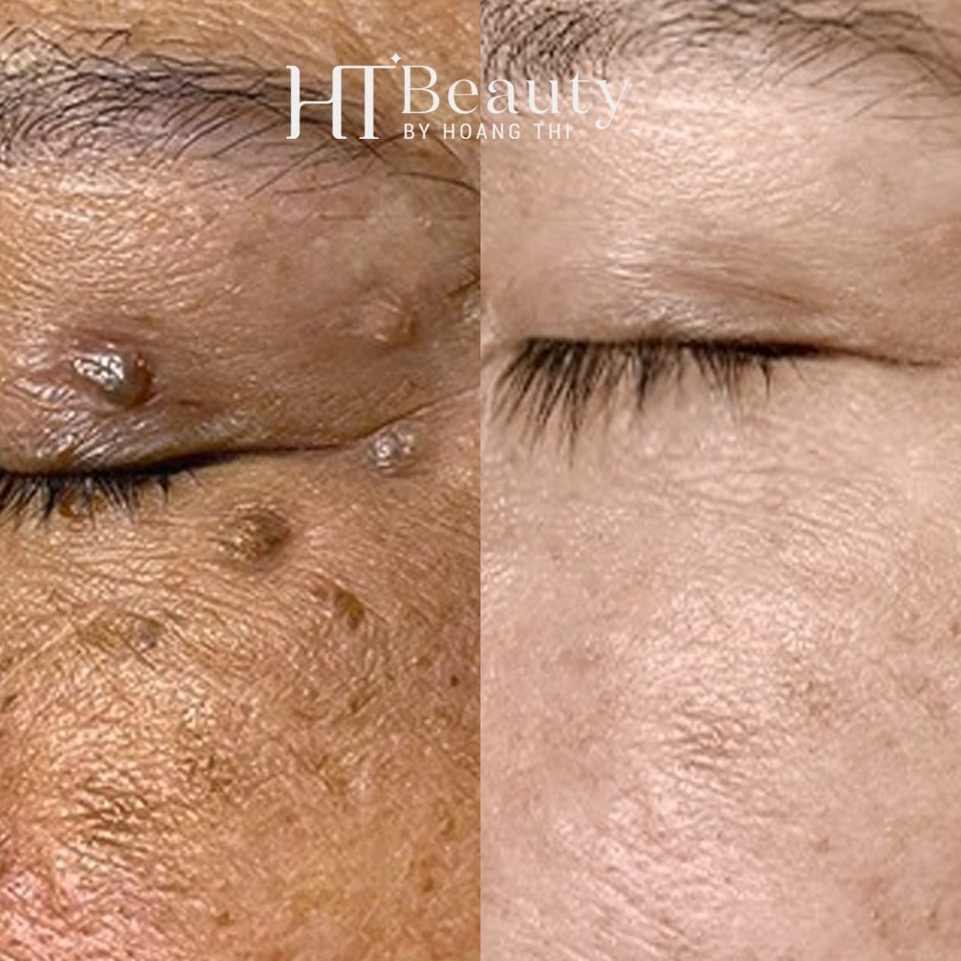 z4144653793674 883b4c2794954cdbfc96110bb6f9753a