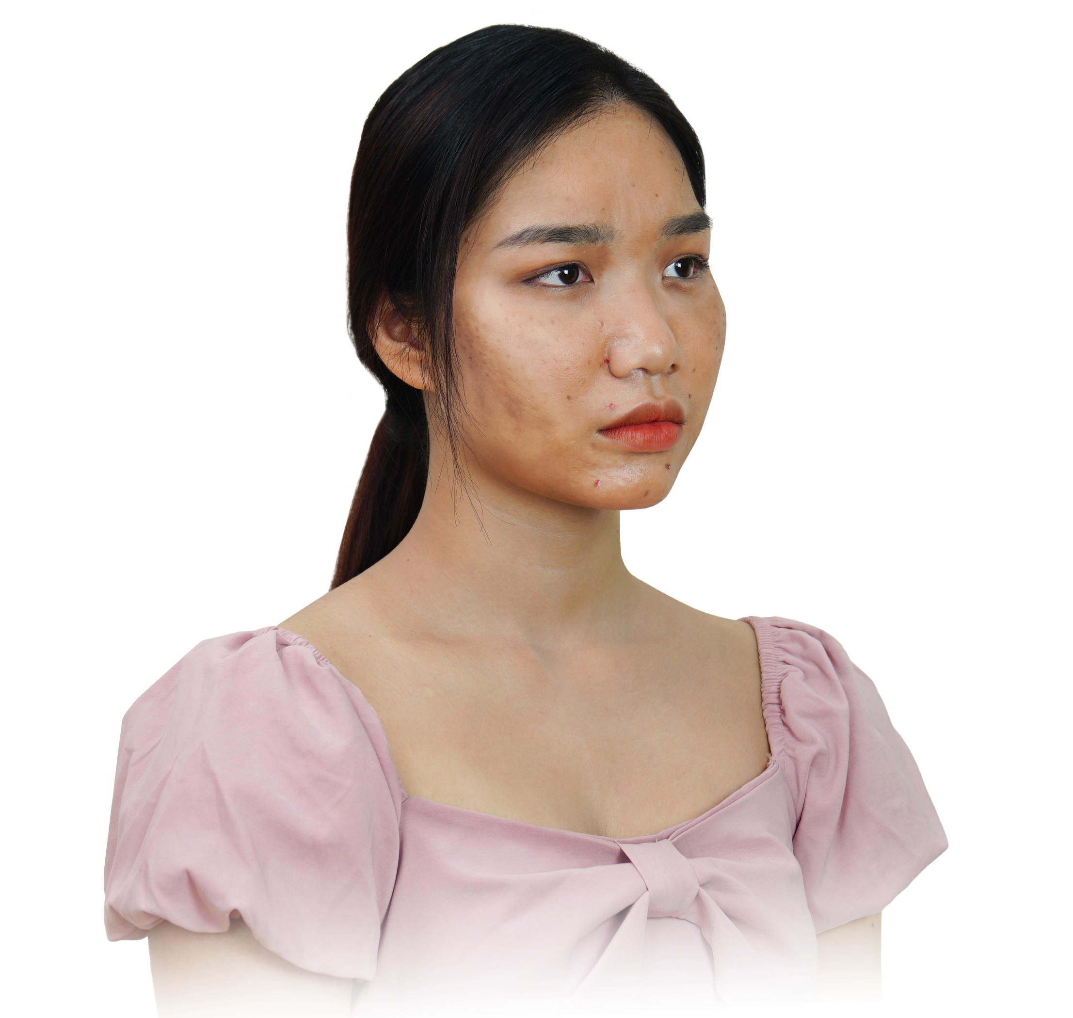 Nổi khổ của da đen sạm