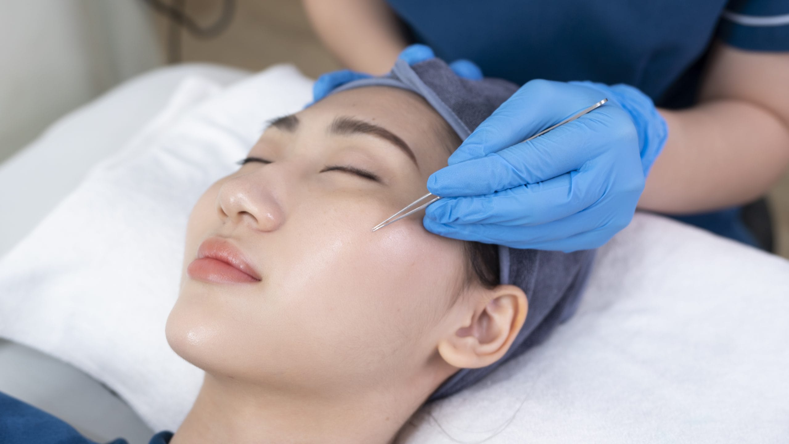 Lấy nhân mụn chuẩn Y Khoa