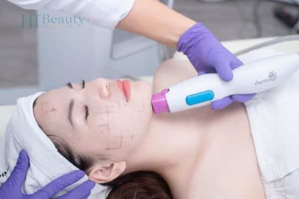 trẻ hóa da bằng Thermage