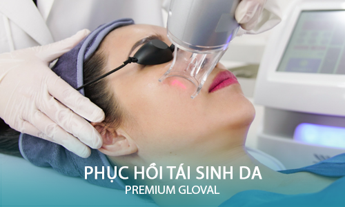 dich vu noi bat premium gloval