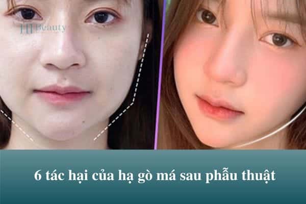 tac hai cua ha go ma 1