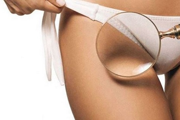 Điều trị thâm bẹn