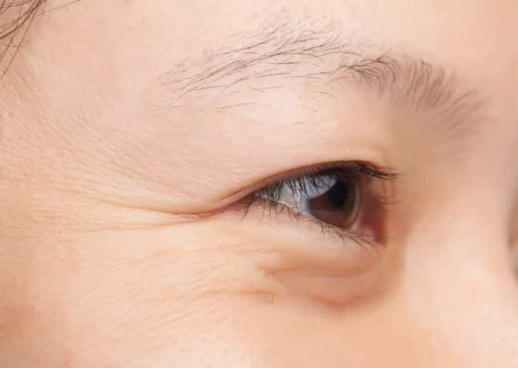 Xuất hiện nhiều nếp nhăn