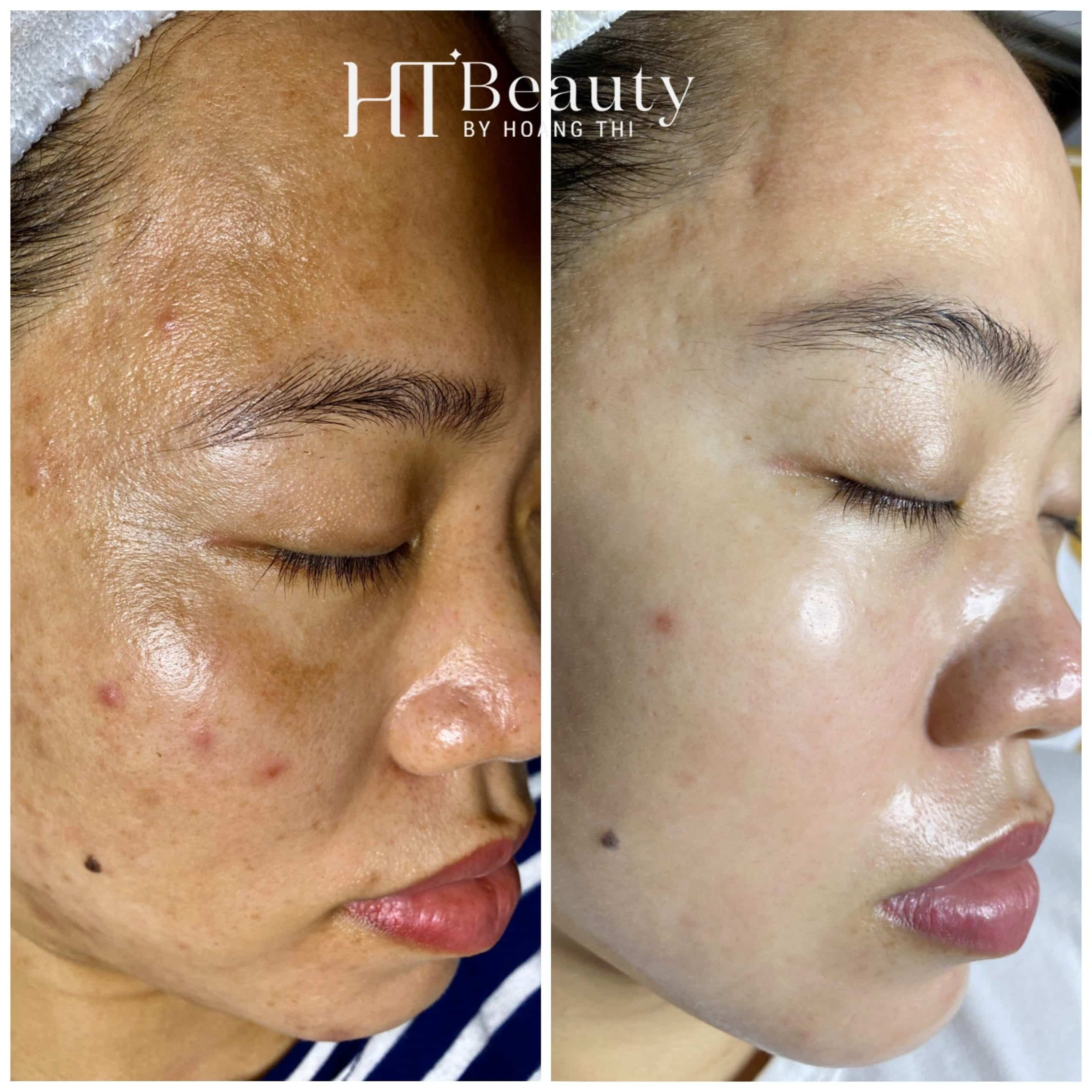 Hình ảnh trước sau khách hàng