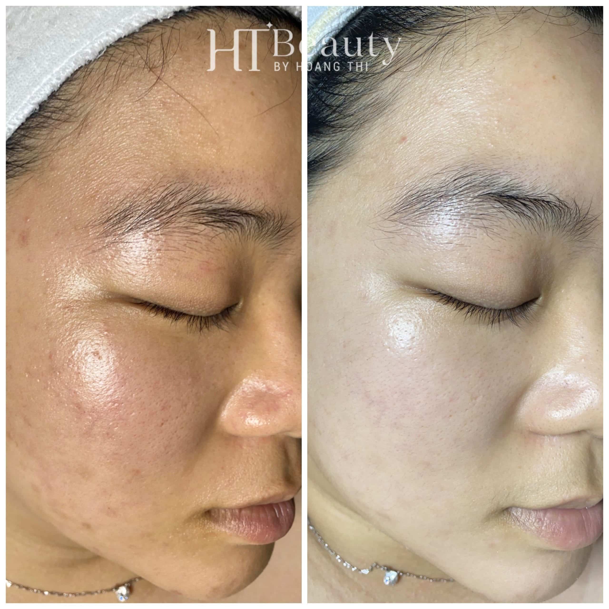 Hình ảnh trước sau khách hàng