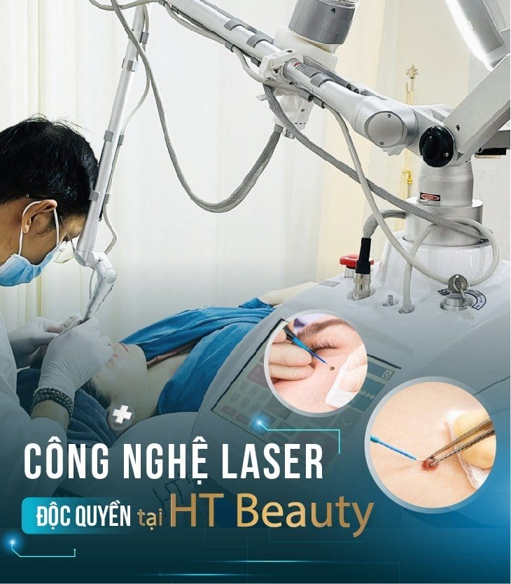 laser