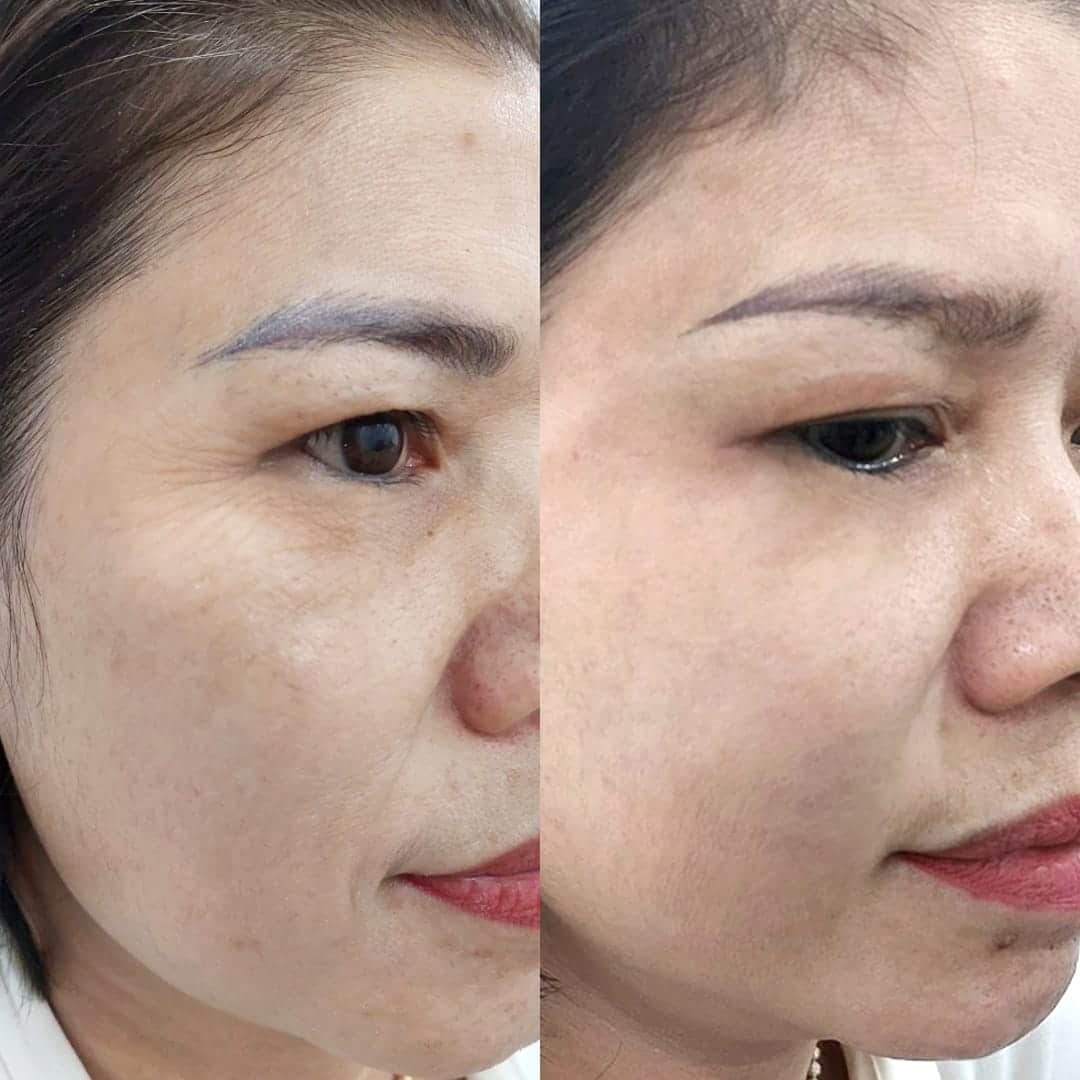 Hiệu quả trẻ hóa của khách hàng