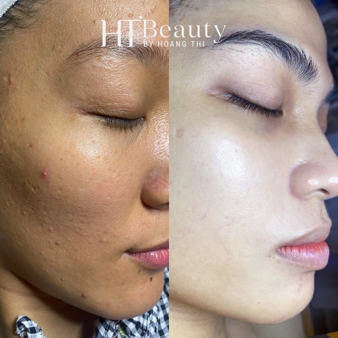 Hình ảnh trước sau của khách hàng