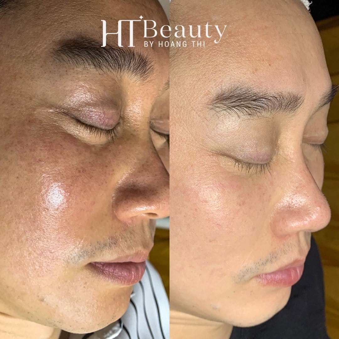 Hình ảnh trước sau của khách hàng