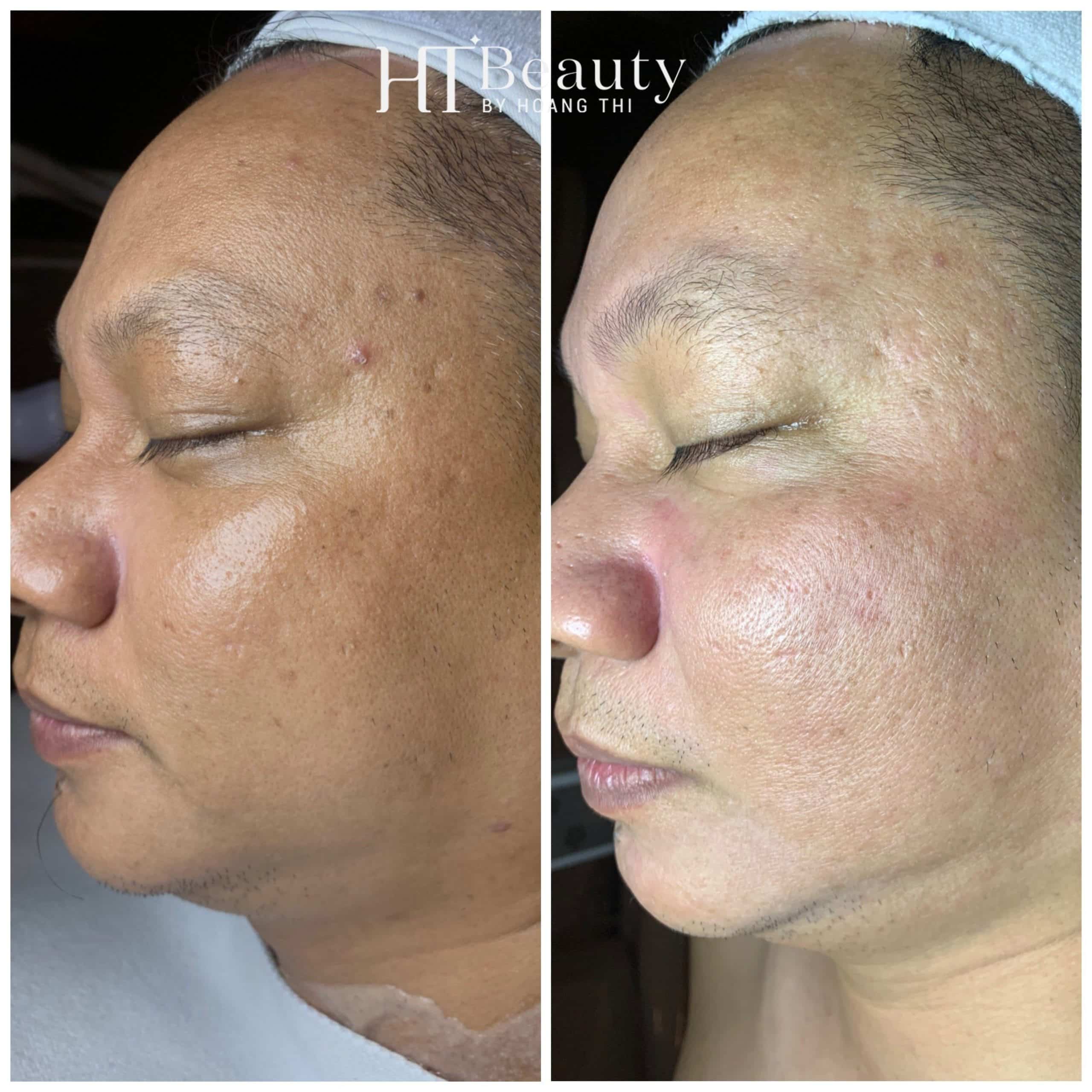 trang sang da 8 scaled