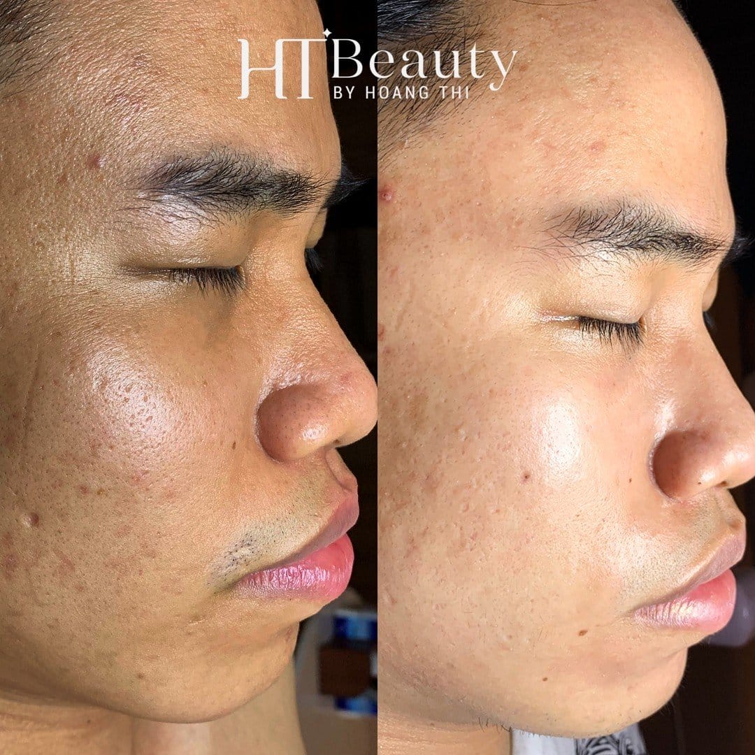 Hình ảnh trước sau của khách hàng