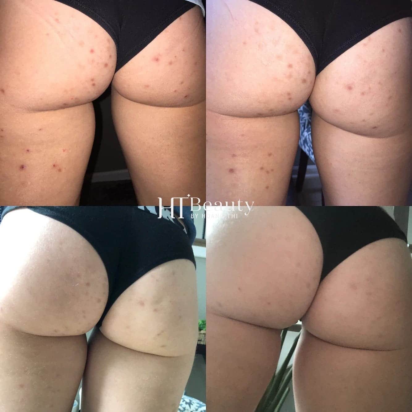 z4242383342249 b1fa55a838d9a0ece26e5845893aa1dd