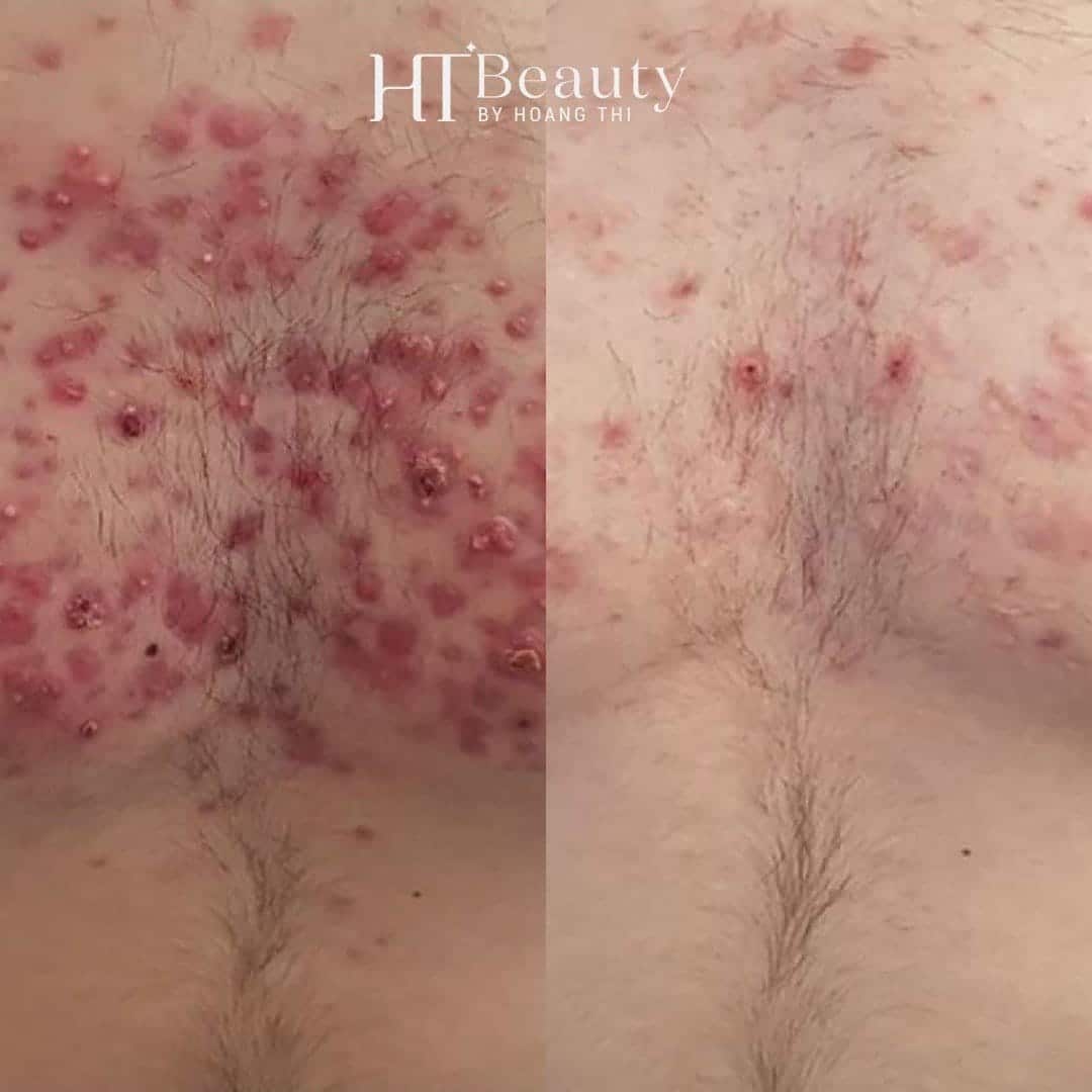 z4242383350013 f225653cc838ff6bb8b030a1b3b85236