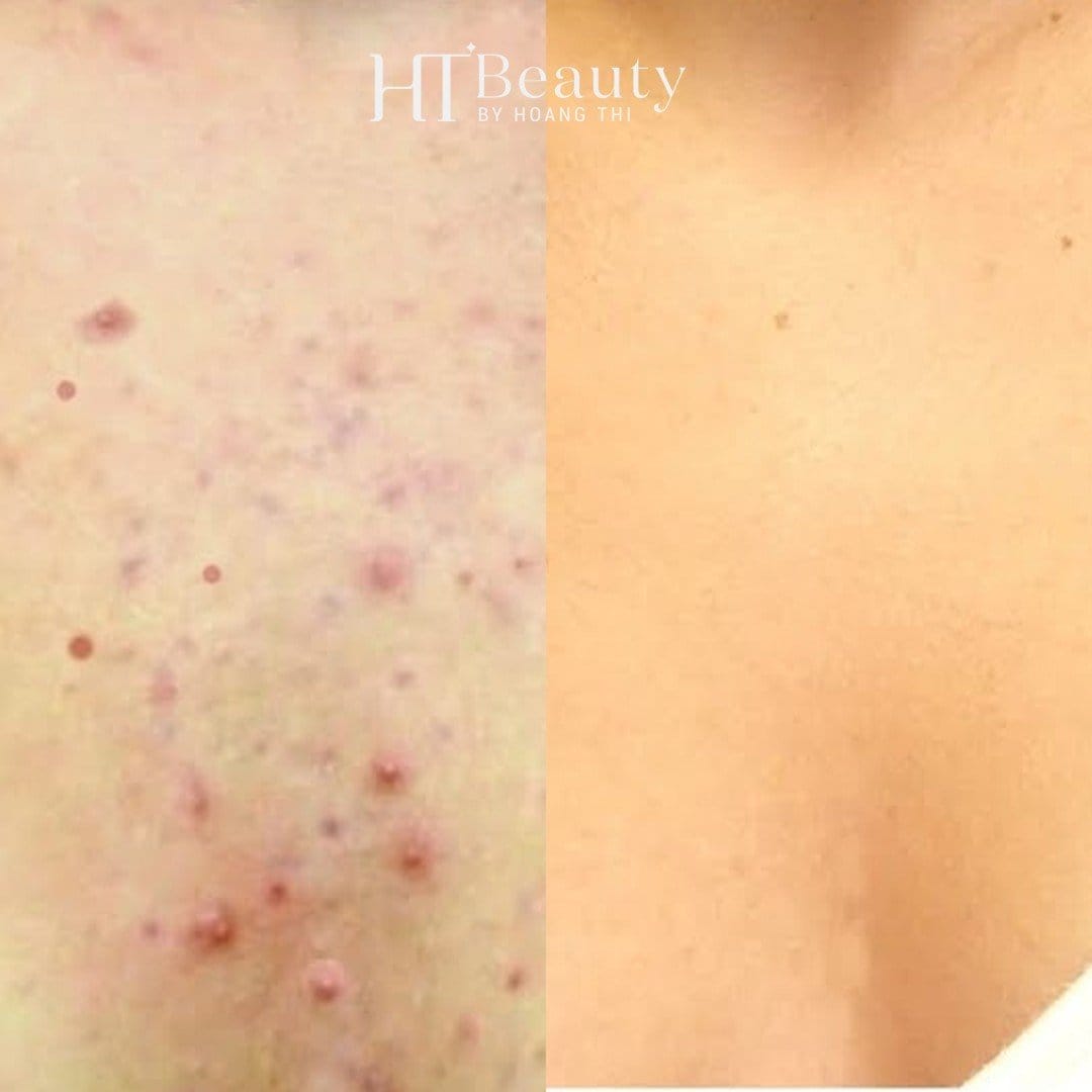 z4242383361264 c21c5a9ce7b9d88a5318e52a9a408ff1