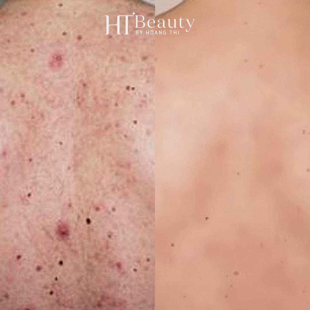 z4242383372252 898e6884ef9a979f0f3286ccf84c8a29