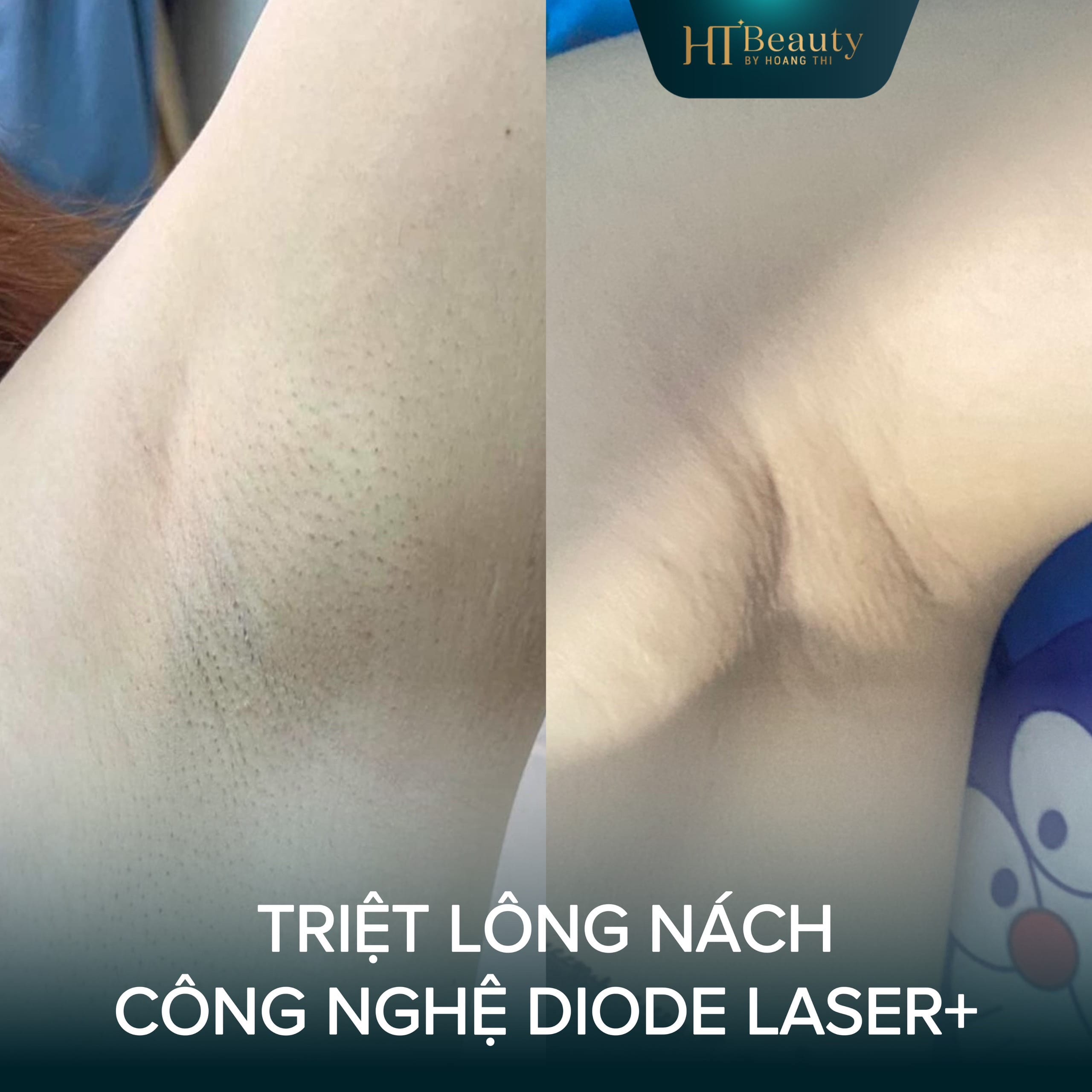 0be92684970e4950101f 1