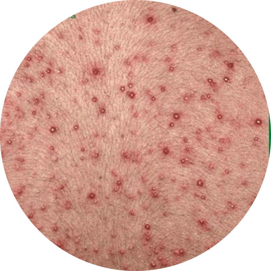 môi trường vi khuẩn