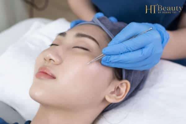 CO NEN NAN MUN TAI NHA 2