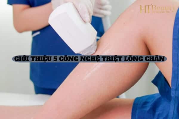 GIOI THIEU 5 CONG NGHE TRIET LONG CHAN