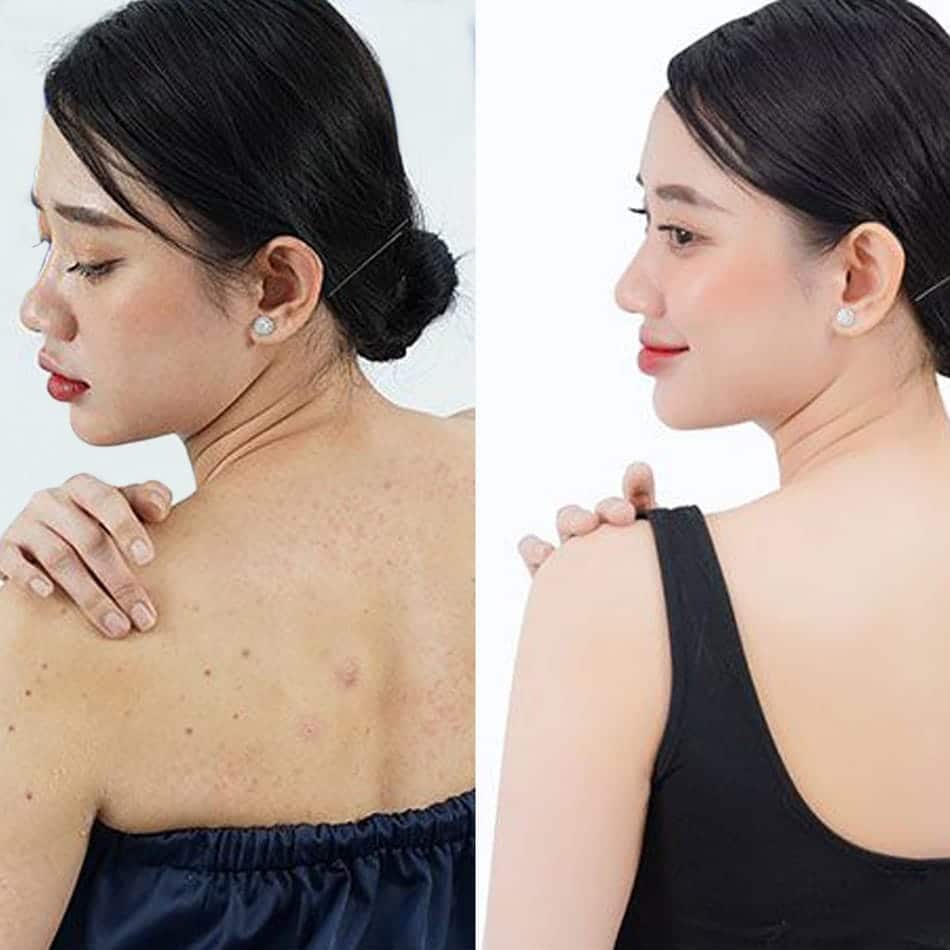 4 20230626134857 pd9b3